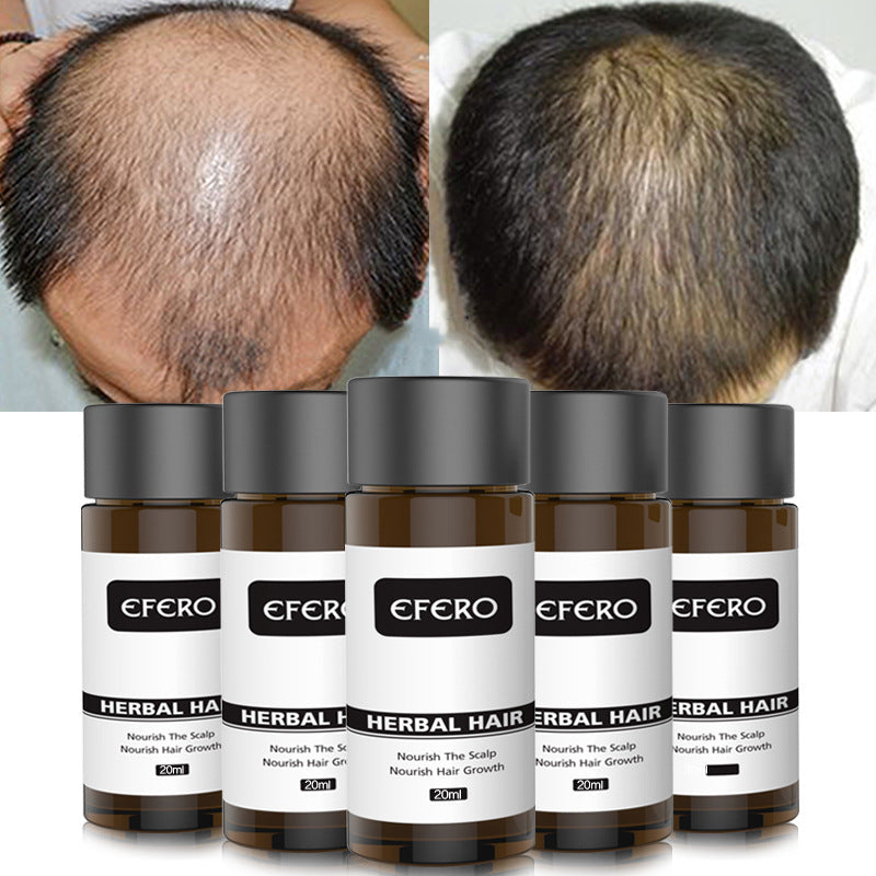 Efero hair growth liquid hair growth liquid dense long-lasting essence accelerates long-term solid hair strong root anti-hair loss