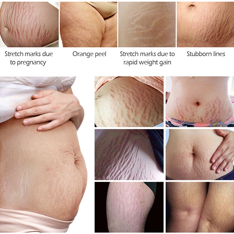 VIBRANT GLAMOUR stretch mark cream