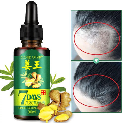 Factory direct skin clothing ginger king hair nutrition liquid spot ginger Wang Sheng liquid can be authorized spot genuine