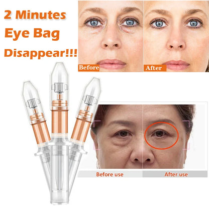 Rejuvenating Eye Cream 120 Seconds Quickly Remove Eye Bags Dark Circles Lifting and Firming Anti-Wrinkle and Fine Lines First Aid Eye Cream oem