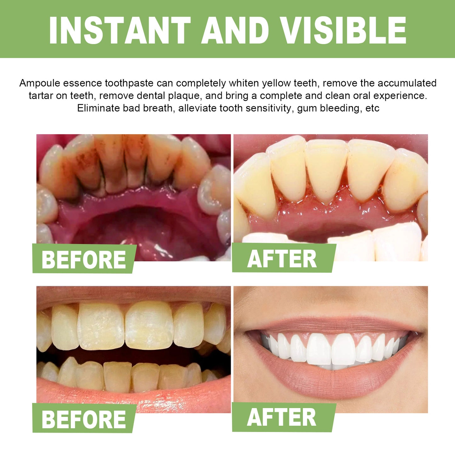 EELHOE Teeth Whitening Essence Cleans Tooth Stains Mouth Odor Beautiful Teeth Brightening Teeth Cleaning Essence